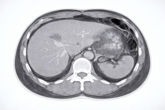 Abdominal Ct Adobe Chubby Kt
