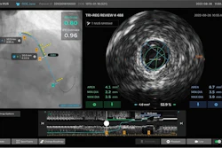 Philips IntraSight Plus screen.