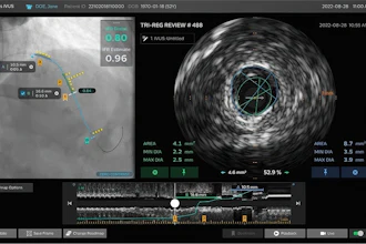 Philips IntraSight Plus screen.