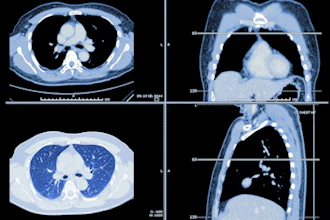 Lung Ct Images 400