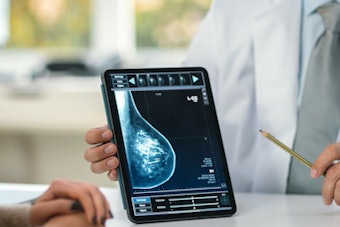 Mammography Breast Ipad Patient 400 (2)