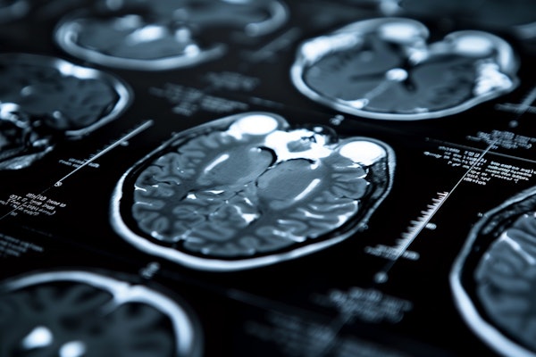 Mri Scan Neurological