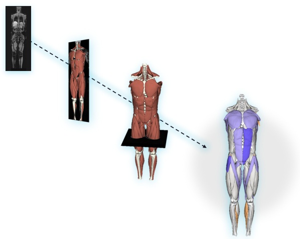 Springbok's AI model converts MRI exams into interactive 3D maps of the musculoskeletal system.