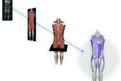 Springbok's AI model converts MRI exams into interactive 3D maps of the musculoskeletal system.