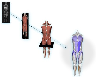 Springbok's AI model converts MRI exams into interactive 3D maps of the musculoskeletal system.