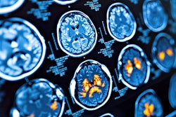 Pet Brain Scan Adobe Michael