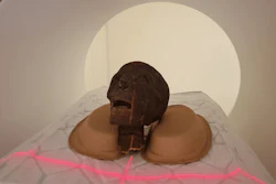 Researchers in Hungary used PCCT imaging to examine Egyptian mummy remains, such as this mummified head.