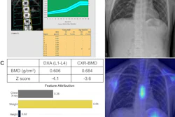 Medical bone density and chest imaging analysis showing DEXA scan results, X-ray, and thermal imaging with BMD measurements