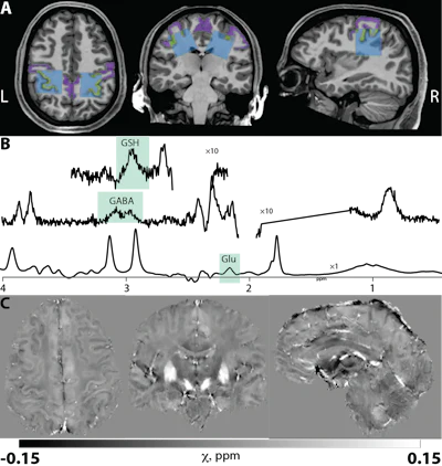 A) Left (L) and right (R) motor cortex MRS voxel locations (blue), AssemblyNet segmented motor cortex (purple), and overlapping area (green). B) Typical GSH spectrum from edited MRS. C) Typical QSM susceptibility maps.