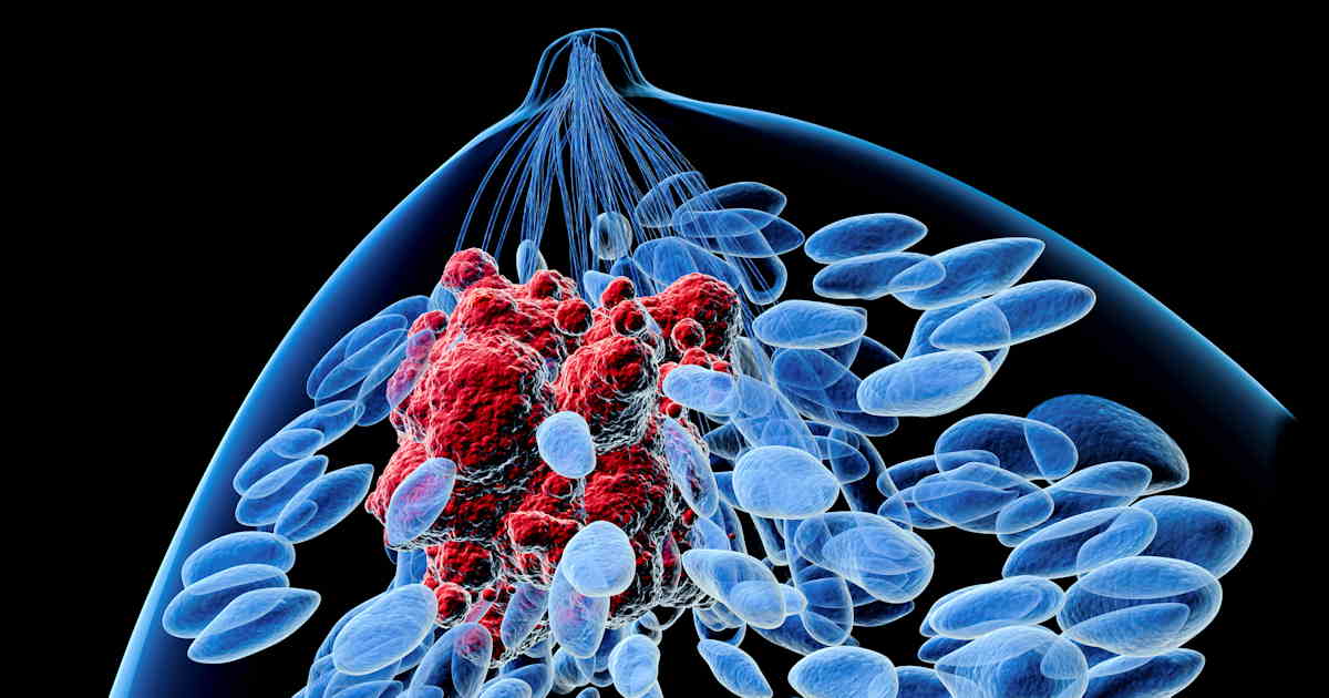 Breast Cancer Social