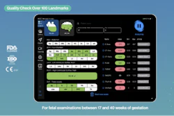 Diagnoly Fetoly Ai Ultrasound I Os