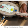 Ellipsys Vascular Access System
