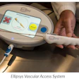Ellipsys Vascular Access System