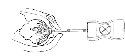 Schematic diagram of self-developed internal tocodynamometry machine.