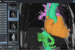 A screenshot of Imricor's Northstar Mapping System.