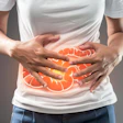 Inflammatory Bowel Crohns