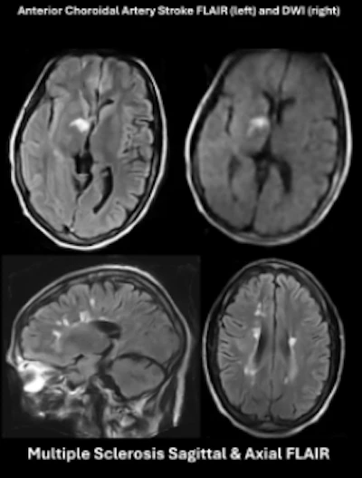 Hyperfine Swoop acquired examples of pathology detected in patients.