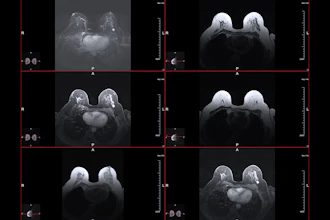 Mri Breast Cancer