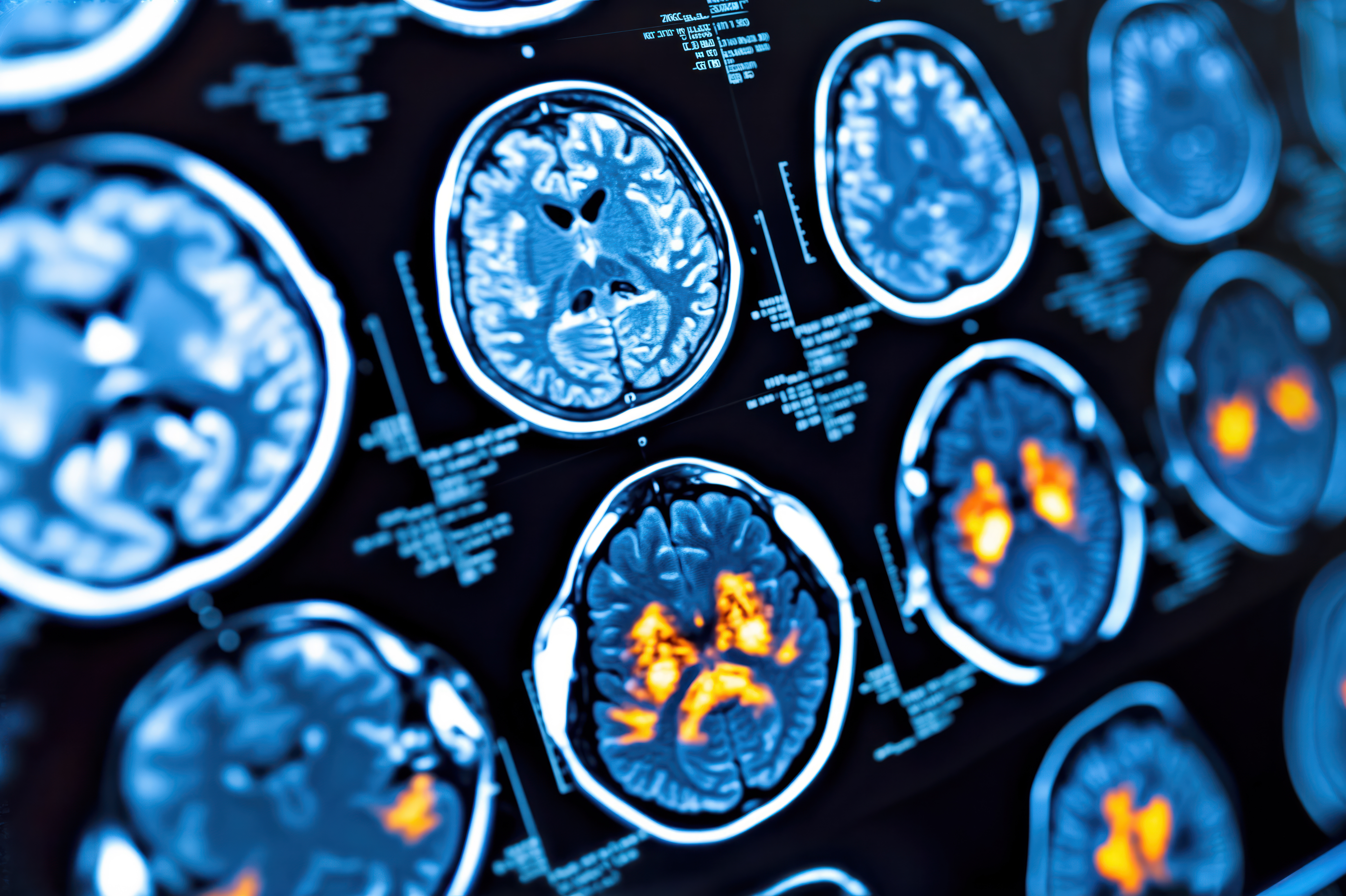 Pet Brain Scan Adobe Michael dim5r Awl G7