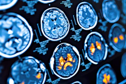 Pet Brain Scan Adobe Michael dim5r Awl G7