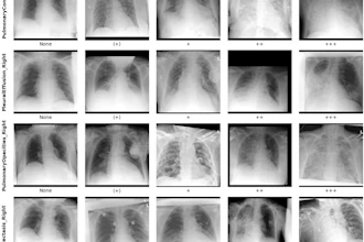 Example radiographs with different labels for 'pulmonary congestion,' 'pleural effusion,' 'pulmonary opacities,' and 'atelectasis.'