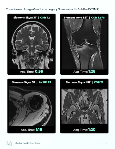 Subtle Hd Capital Health Case Study (3) Page 4