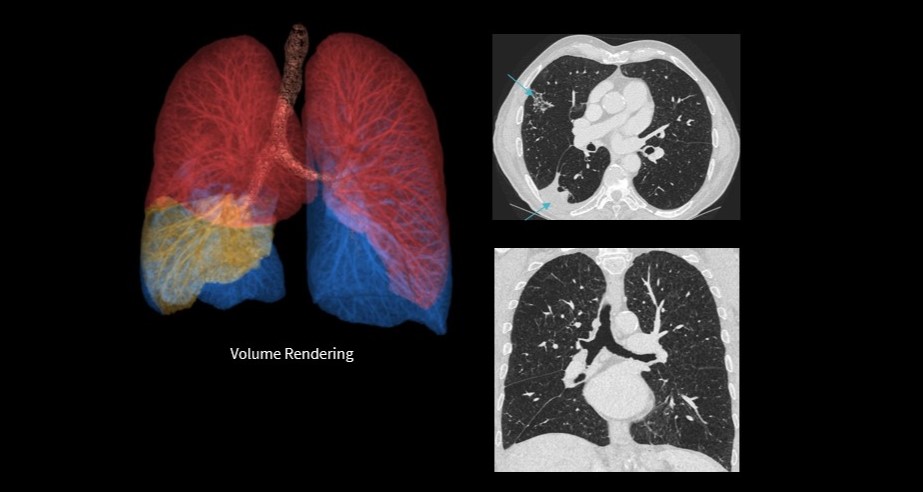 True Definition Dl Chest Exam