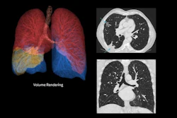 A chest exam from the True Definition DL system.
