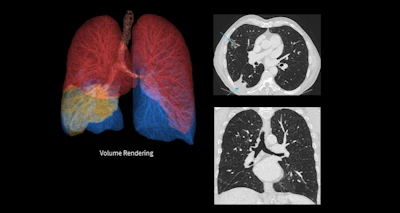 A chest exam from the True Definition DL system.