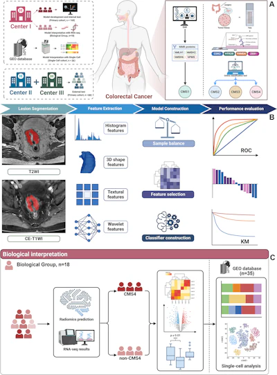 Overview of the study design, including data collection, radiomics model construction, and biologic interpretation. (A) The primary cohort for model development and evaluation in the training and internal test sets includes 168 patients with colorectal cancer (CRC) from center 1 (Fudan University Shanghai Cancer Center), whereas external testing was performed using data from 85 patients from centers 2 (Huashan Hospital, Fudan University) and 3 (Zhongshan Hospital, Fudan University). For model interpretation, RNA sequencing (RNA-seq) data from 18 patients with CRC in center 1 and single-cell data from 35 patients from the Gene Expression Omnibus (GEO) database are incorporated. Mismatch repair (MMR) protein expression, obtained from pathologic reports in electronic medical records (EMRs), was used to identify patients with consensus molecular subtype 1 (CMS1) CRC. Tissue microarrays (TMAs) from surgically obtained CRC tissues were analyzed for immunohistochemical staining of caudal-type homeobox 2 (CDX2), 5-hydroxytryptamine receptor 2B (HTR2B), FERM domain containing 6 (FRMD6), and zinc finger E-box binding homeobox 1 (ZEB1), and the results were subsequently entered into an online classification tool that assigned patients to CMS2, 3, or 4 subtypes. (B) Radiomics workflow for CMS4 prediction. Lesions were manually delineated on T2-weighted imaging (T2WI) and contrast-enhanced (CE) T1-weighted imaging (T1WI), followed by radiomics feature extraction. Feature selection and model development were performed in the training set using machine-learning algorithms with fivefold cross-validation for model selection, and the final model was evaluated in the internal and external test sets using receiver operating characteristic (ROC) curve analysis. (C) Transcriptomic interpretation workflow. Using the radiomics-predicted CMS4 classification, bulk RNA sequencing (RNA-seq) data were used to perform differential expression analysis between predicted CMS4 and non-CMS4 groups, followed by pathway enrichment analyses to assess biologic relevance. Public single-cell RNA sequencing data from the Gene Expression Omnibus database were then used for cell-type–level interrogation to support interpretation of the associated pathways.