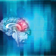 Brain Abstract