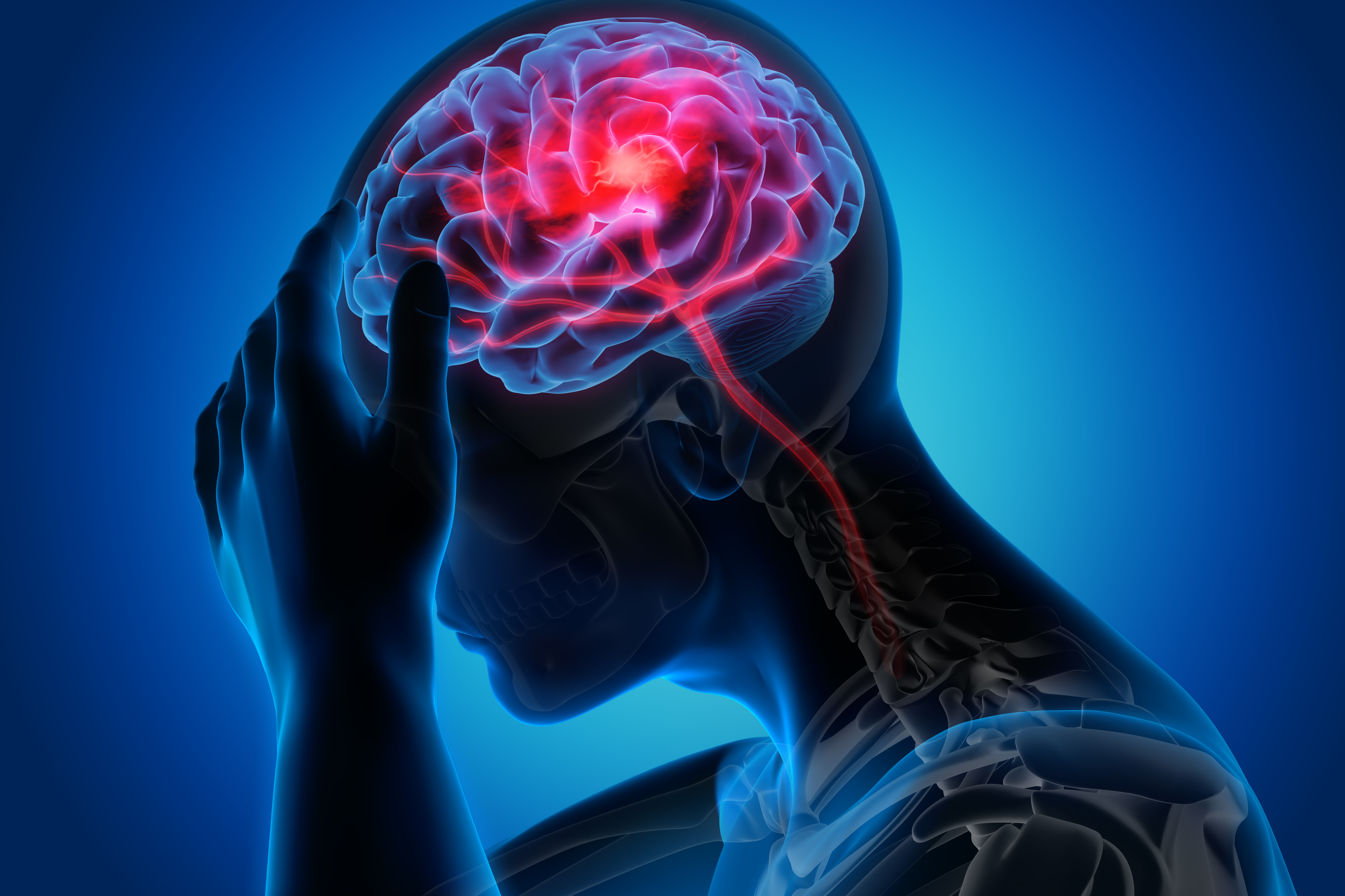 Brain Stroke