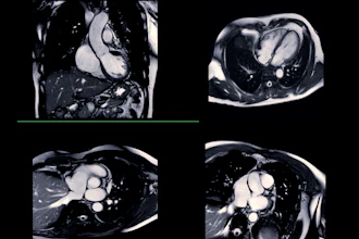 Cardiac Mri Adobe Samunella
