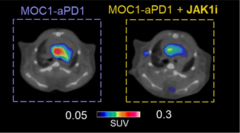 Combination therapy of JAK1i with anti-PD1 slows down tumor growth and reduces CCR2+ cells infiltration in atherosclerotic lesions compared to anti-PD1 alone. Representative PET images of cardio-oncology mice treated with anti-PD1 alone or in combination with JAK1i. The PET uptake was normalized by subtracting blood retention.