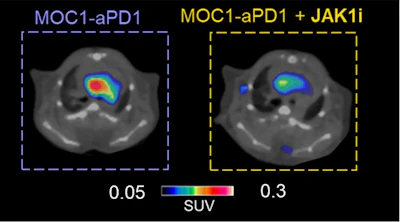 Combination therapy of JAK1i with anti-PD1 slows down tumor growth and reduces CCR2+ cells infiltration in atherosclerotic lesions compared to anti-PD1 alone. Representative PET images of cardio-oncology mice treated with anti-PD1 alone or in combination with JAK1i. The PET uptake was normalized by subtracting blood retention.