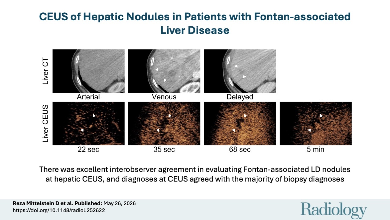 A visual abstract of the study.