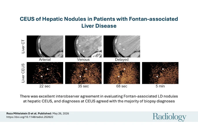 A visual abstract of the study.