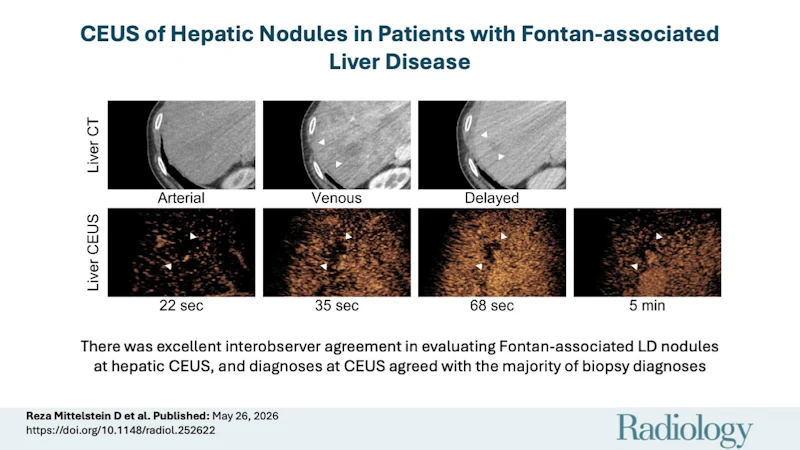 CEUS shows promise in patients with Fontan-associated liver disease ...