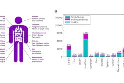 Fibrotic Buckets Disease Inclusion Uk Biobank Population Ismrm2026
