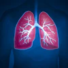 Lung General