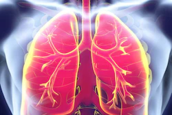 Lungs 2
