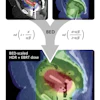 MIM ComboTherapy GYN HDR/EBRT provides a visual and quantitative approach to dose summation across treatment modalities.