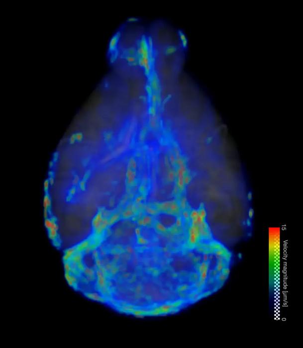 A 3D visualization shows the flow speed of fluid across the brain.