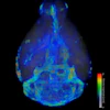 A 3D visualization shows the flow speed of fluid across the brain.