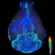 A 3D visualization shows the flow speed of fluid across the brain.
