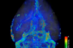 A 3D visualization shows the flow speed of fluid across the brain.