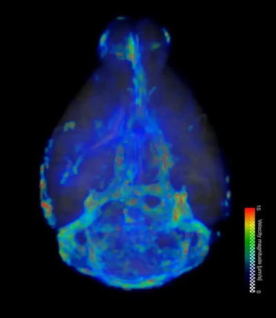 A 3D visualization shows the flow speed of fluid across the brain.