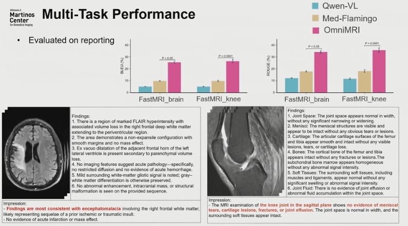 OmniMRI in the context of reporting.