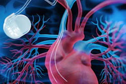 Pacemaker Heart 400