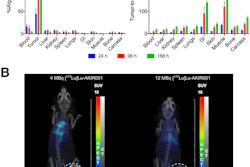 Biodistribution of Lu-177 AKIR001. (A) Mice (N = 12) bearing BxPC3 tumors were injected with Lu-177 AKIR001 and dissected at 24 (N = 4), 96 (N = 4), and 168 hours (N = 4) postinjection. Error bars represent SD. (B) Representative SPECT/CT images at 96 hours postinjection. GI = gastrointestinal.